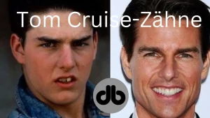 Tom Cruise-Zähne