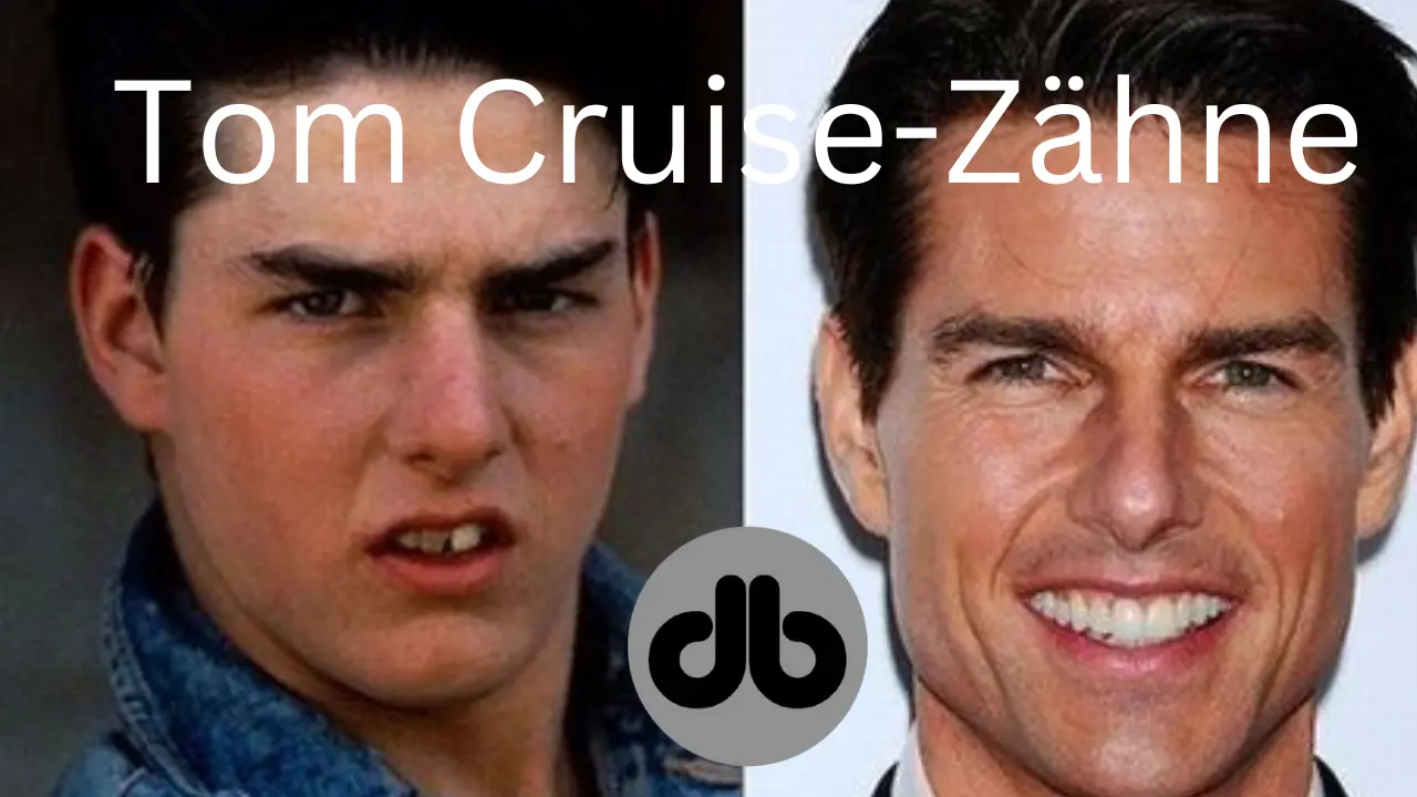 Tom Cruise-Zähne vorher und nachher – Sehen Sie sich hier die neuesten Tom Cruise-Updates an!