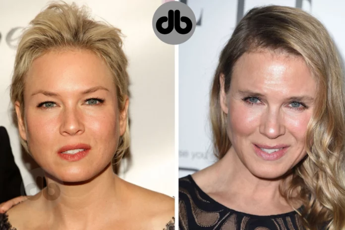 Renee Zellweger vorher und nachher