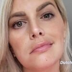 ANGELINA-KIRSCH-mit-Gesichtslaehmung