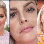 ANGELINA KIRSCHs Gesichtslähmung ist noch sichtbar