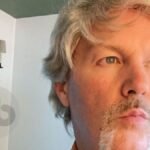 Fred-Durst-Krankheit