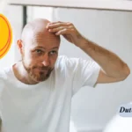 Haarausfall verstehen