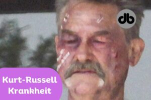 Kurt-Russell-Krankheit
