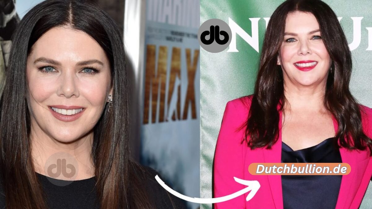 Lauren Graham Plastische Chirurgie