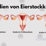 Symptome-und-Diagnose