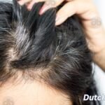 Ursachen-fuer-vorzeitig-weisses-Haar